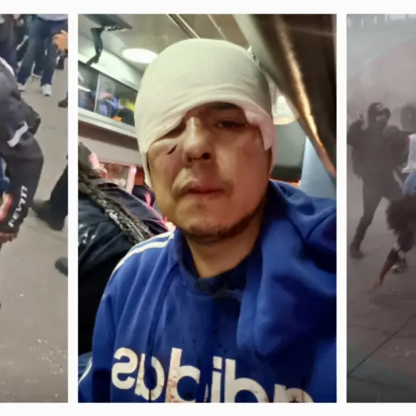 Fotoperiodistas lesionados en marcha del 2 de Octubre en CDMX: uno hospitalizado y dos con golpes en la cabeza