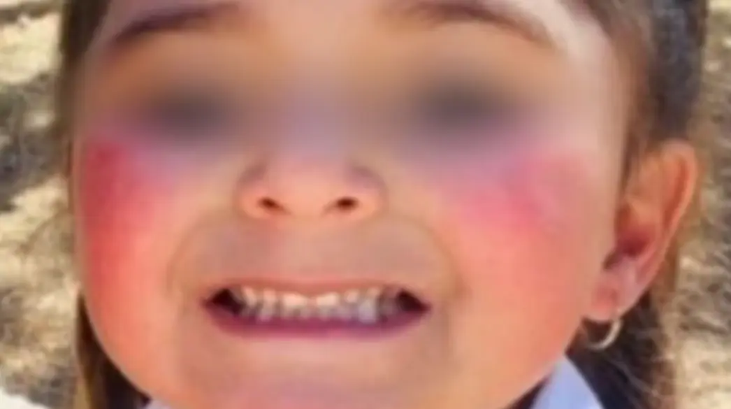 La pequeña de 4 años falleció tras una larga espera por una cirugía. Especial