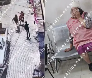 Le dio un cabezazo para robarle 800 pesos: Sujeto agrede brutalmente a abuelita en Álvaro Obregón