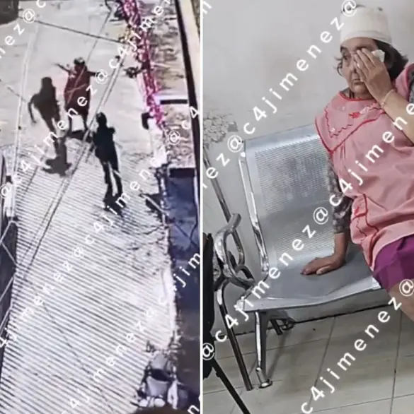 Le dio un cabezazo para robarle 800 pesos: Sujeto agrede brutalmente a abuelita en Álvaro Obregón