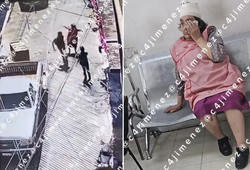 Sujeto agrede brutalmente a abuelita en &Aacute;lvaro Obreg&oacute;n