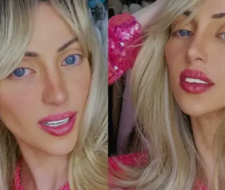 Muere la "Barbie humana" a los 31 años tras someterse a 27 cirugías estéticas