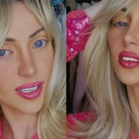 Muere la "Barbie humana" a los 31 años tras someterse a 27 cirugías estéticas Muere la "Barbie humana" a los 31 años tras someterse a 27 cirugías estéticas