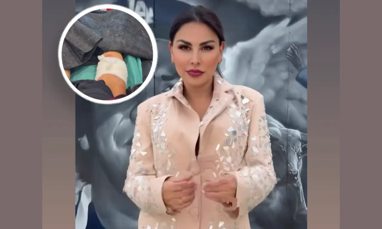  Famosa conductora de Televisa es hospitalizada tras ser atacada por un perro: "Mi pierna está destrozada" 