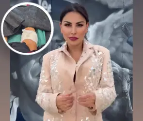 Famosa conductora de Televisa es hospitalizada tras ser atacada por un perro: Mi pierna está destrozada