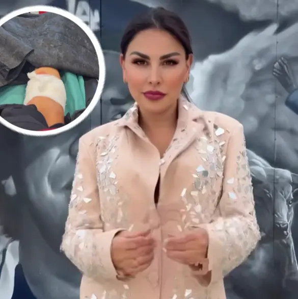 Famosa conductora de Televisa es hospitalizada tras ser atacada por un perro: Mi pierna está destrozada