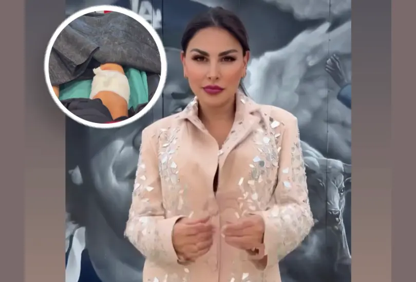 Famosa conductora de Televisa es hospitalizada tras ser atacada por un perro: Mi pierna está destrozada