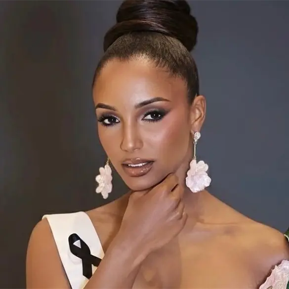 Reportan a Miss Jamaica en terapia intensiva tras grave caída en Miss Universo