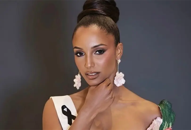 Miss Jamaica continúa hospitalizada