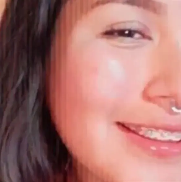 Ximena murió afuera del Metro Politécnico tras explotarle petardo en la cabeza por un ataque porril