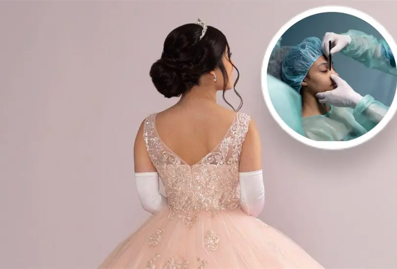 Fernanda se hizo una rinoplastia por sus XV años, pero sufrió un derrame cerebral en clínica de CDMX Fernanda se hizo una rinoplastia por sus XV años, pero sufrió un derrame cerebral en clínica de CDMX