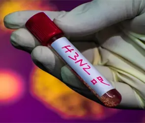 "S&uacute;per gripe" llega a M&eacute;xico: confirman el primer caso de influenza H3N2 