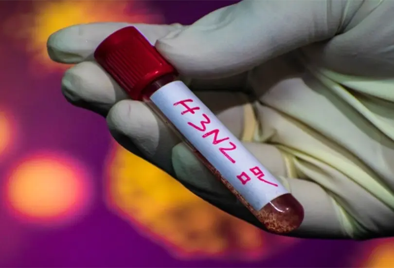 S&uacute;per Gripe H3N2 en M&eacute;xico: &iquest;cu&aacute;les son los s&iacute;ntomas? 