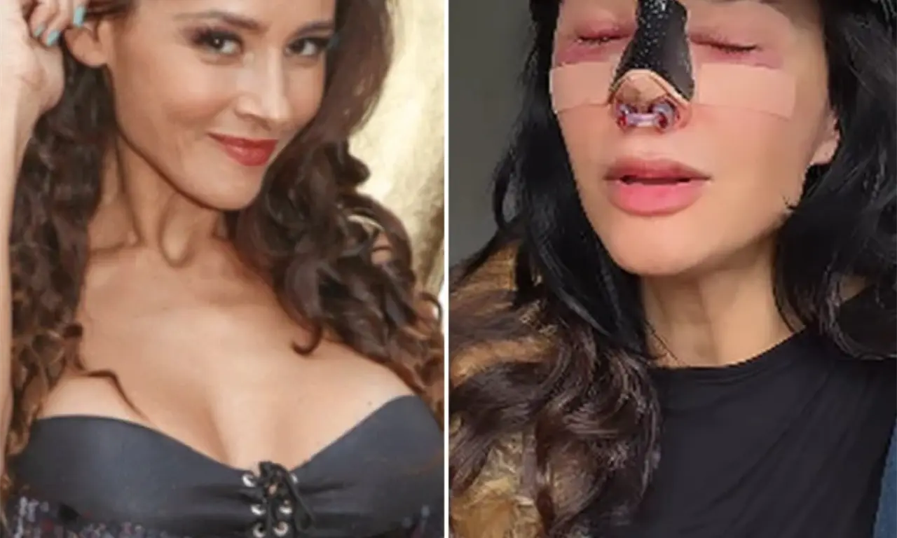  La actriz de “Gata salvaje” dio a conocer que tras una mala cirugía estética se encuentra actualmente en rehabilitación. 