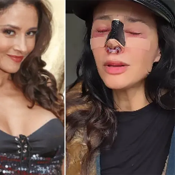 "Fue una mala praxis": Dorismar reaparece tras cirugía estética que le desfiguró el rostro "Fue una mala praxis": Dorismar reaparece tras cirugía estética que le desfiguró el rostro