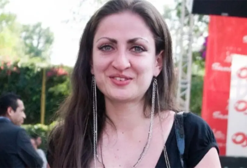 Celia Lora es una de las famosas que se ha ayudado de las cirug&iacute;as est&eacute;ticas para mejorar su imagen.