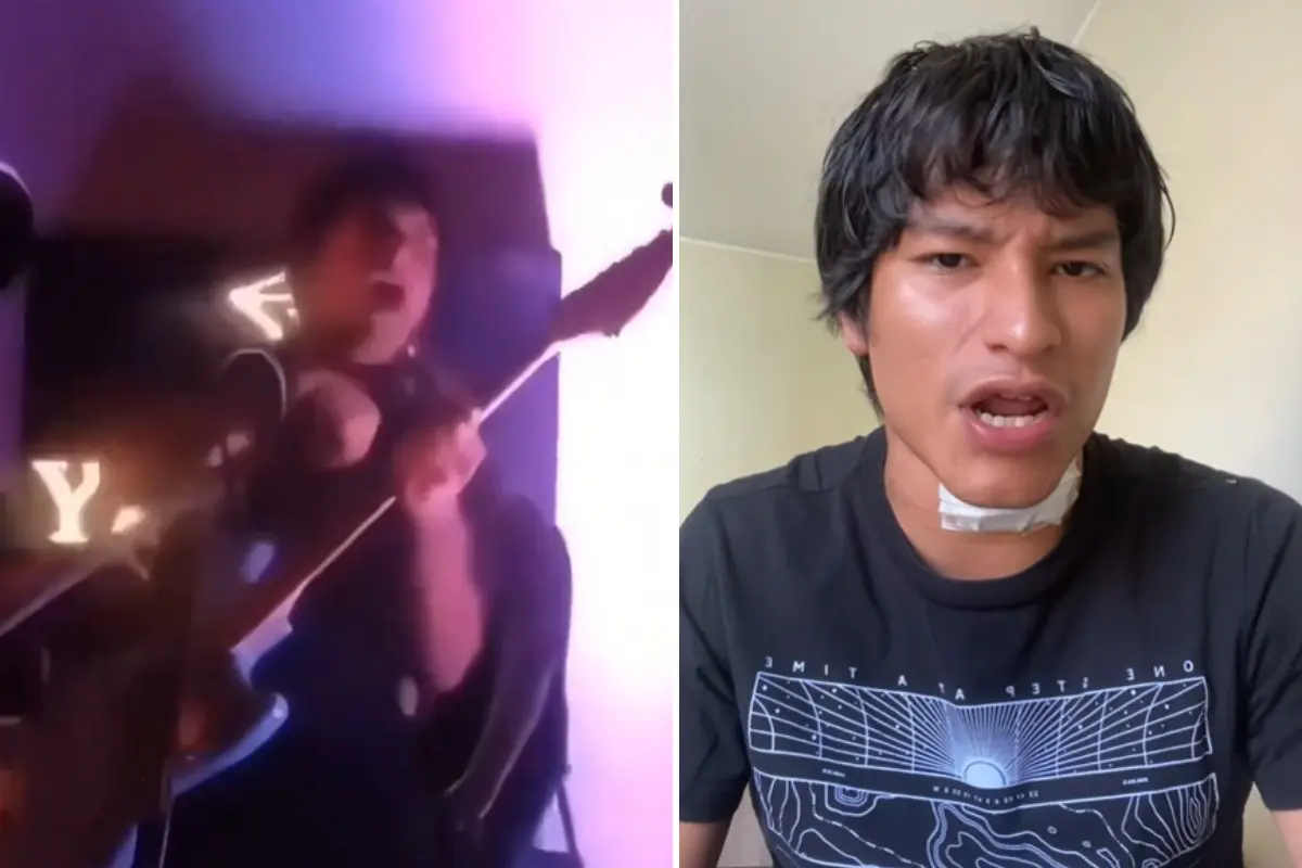  Mi Mejor Amigo Scott: vocalista sufre descarga eléctrica en vivo 