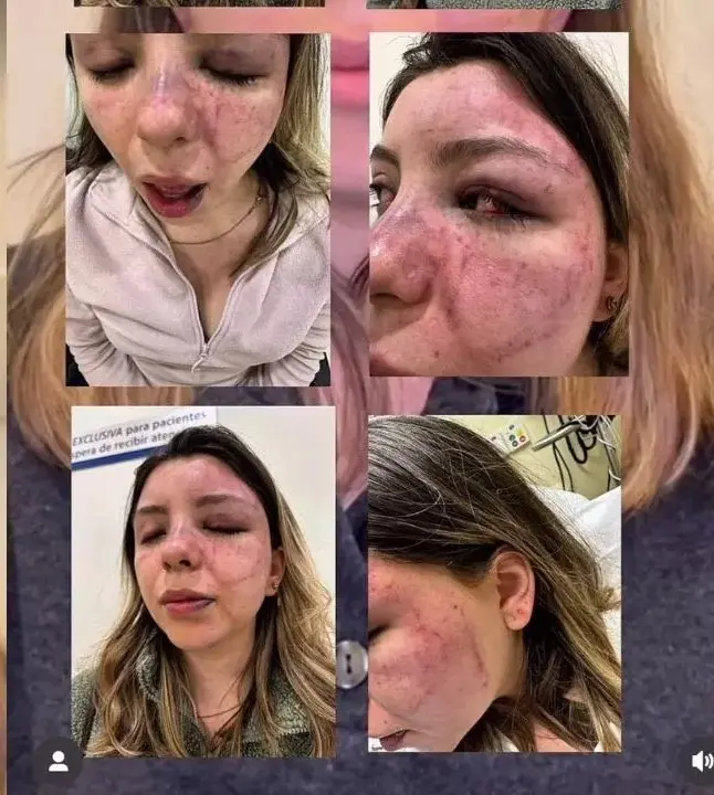 Ana Caterina Marino Especial