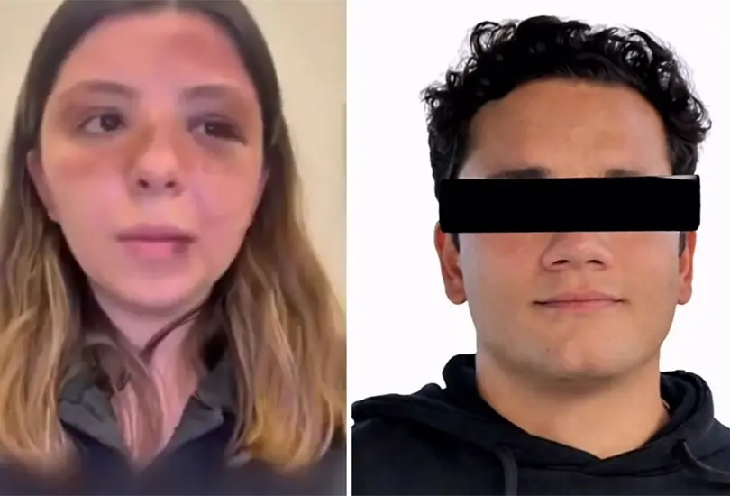 Ana Caterina Marino denuncia violenta agresión de su expareja Ana Caterina Marino denuncia violenta agresión de su expareja