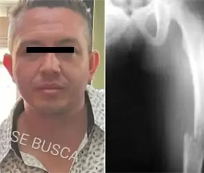 Erick Antonio, presunto feminicida de Cuautitl&aacute;n, ya ten&iacute;a cargos por romperle el f&eacute;mur a su hijastro de 6 a&ntilde;os