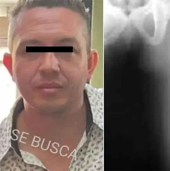 Erick Antonio, presunto feminicida de Cuautitl&aacute;n, ya ten&iacute;a cargos por romperle el f&eacute;mur a su hijastro de 6 a&ntilde;os