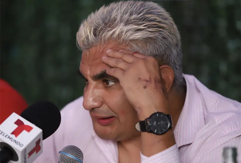 Shocker protagoniza violenta pelea con su esposa; terminó herido de una mano Shocker protagoniza violenta pelea con su esposa; terminó herido de una mano