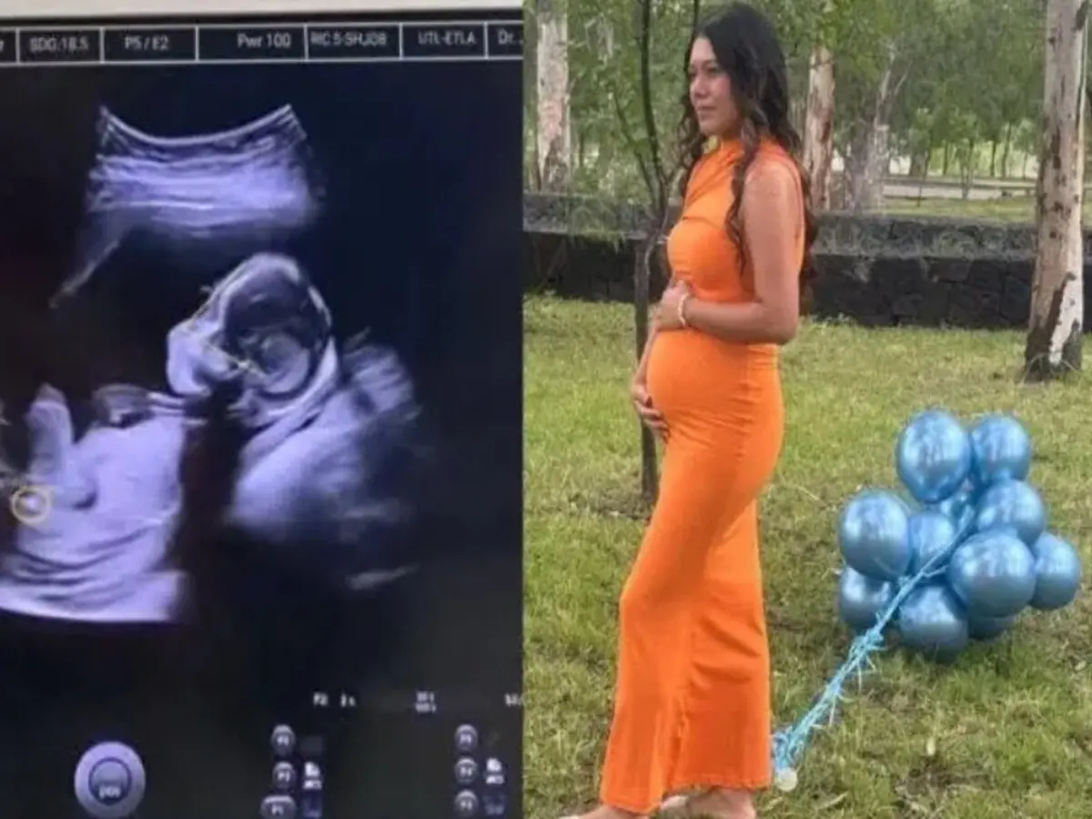  El caso de Lidya Valdivia generó polémica luego de que la Fiscalía negara un embarazo reciente. 