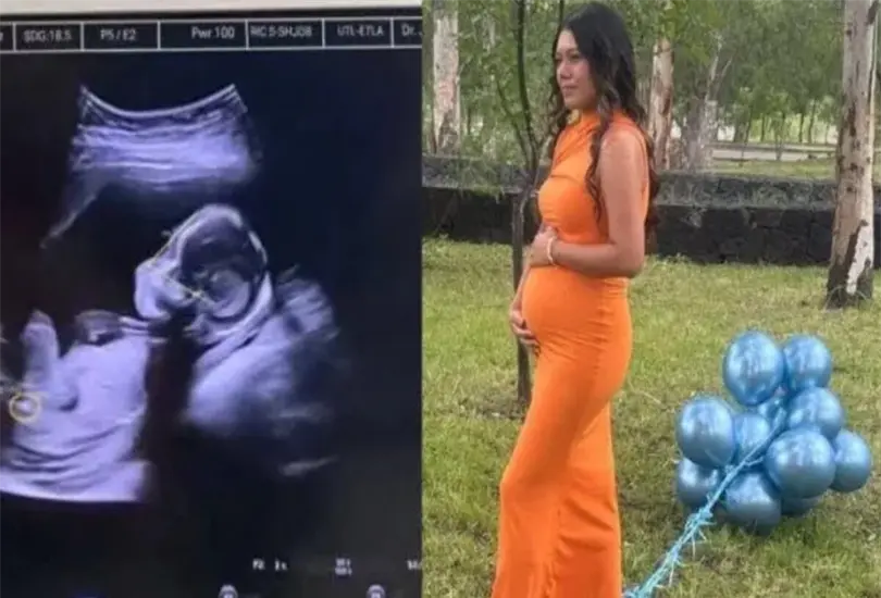 El caso de Lidya Valdivia generó polémica luego de que la Fiscalía negara un embarazo reciente. El caso de Lidya Valdivia generó polémica luego de que la Fiscalía negara un embarazo reciente.