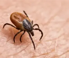 &iquest;Qu&eacute; es la rickettsiosis? S&iacute;ntomas y alerta en Baja California tras muerte de tres ni&ntilde;os en 2026