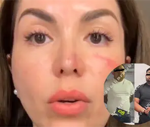 Detienen a tres por brutal robo contra influencer Evelyn Villa en Toluca