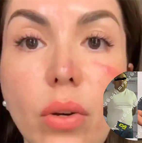 Detienen a tres por brutal robo contra influencer Evelyn Villa en Toluca