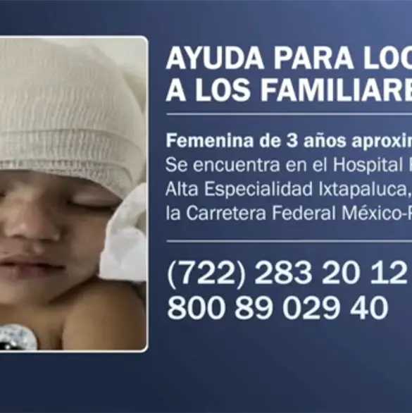 Buscan a familia de ni&ntilde;a herida tras tr&aacute;gico accidente en Chalco: difunden su imagen para identificarla