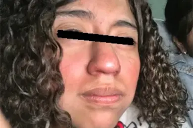 &iquest;Qui&eacute;n era Ximena Abigail, la adolescente que muri&oacute; tras caerle encima un cazo de aceite hirviendo?