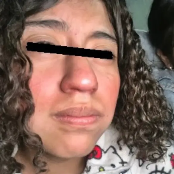 &iquest;Qui&eacute;n era Ximena Abigail, la adolescente que muri&oacute; tras caerle encima un cazo de aceite hirviendo?