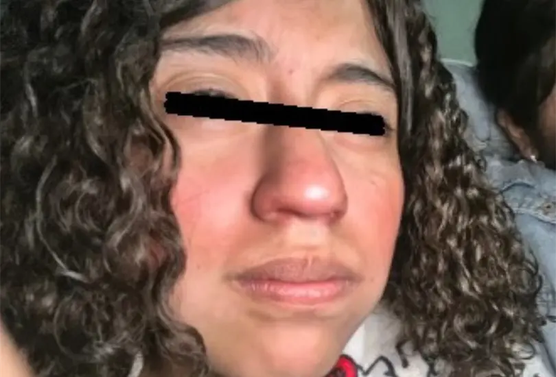 Los reportes m&eacute;dicos indicaron que presentaba quemaduras en aproximadamente el 70 por ciento de su cuerpo, de segundo y tercer grado.