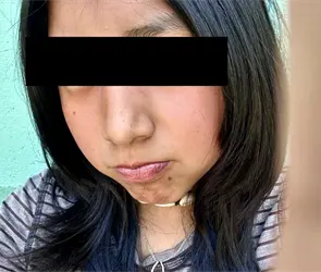 Localizan sin vida a Yolet Saray tras desaparici&oacute;n en Amanalco; investigan posible feminicidio