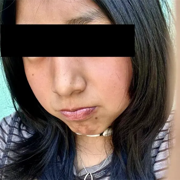 Localizan sin vida a Yolet Saray tras desaparici&oacute;n en Amanalco; investigan posible feminicidio