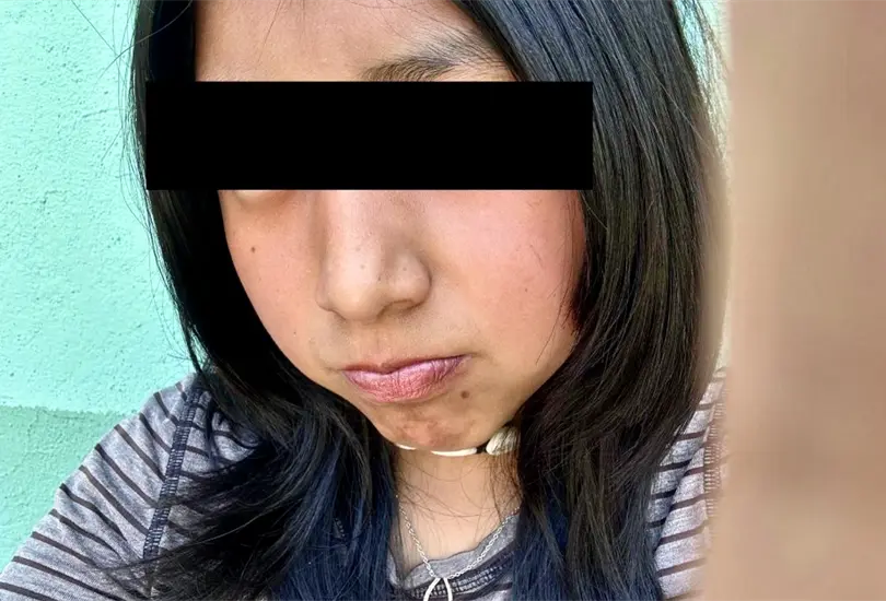 Localizan sin vida a Yolet Saray tras desaparici&oacute;n en Amanalco; investigan posible feminicidio