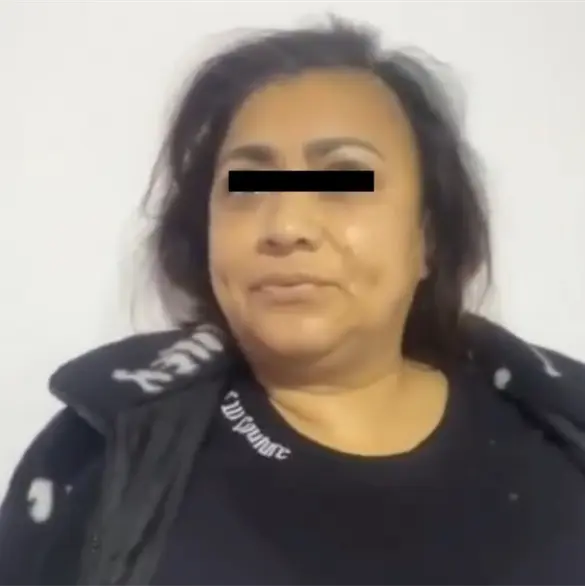 Revelan cu&aacute;les fueron las &uacute;ltimas palabras de Yulixa Toloza tras su cirug&iacute;a en una est&eacute;tica