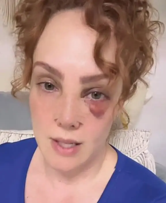 Fran Meric sufre accidente TikTok