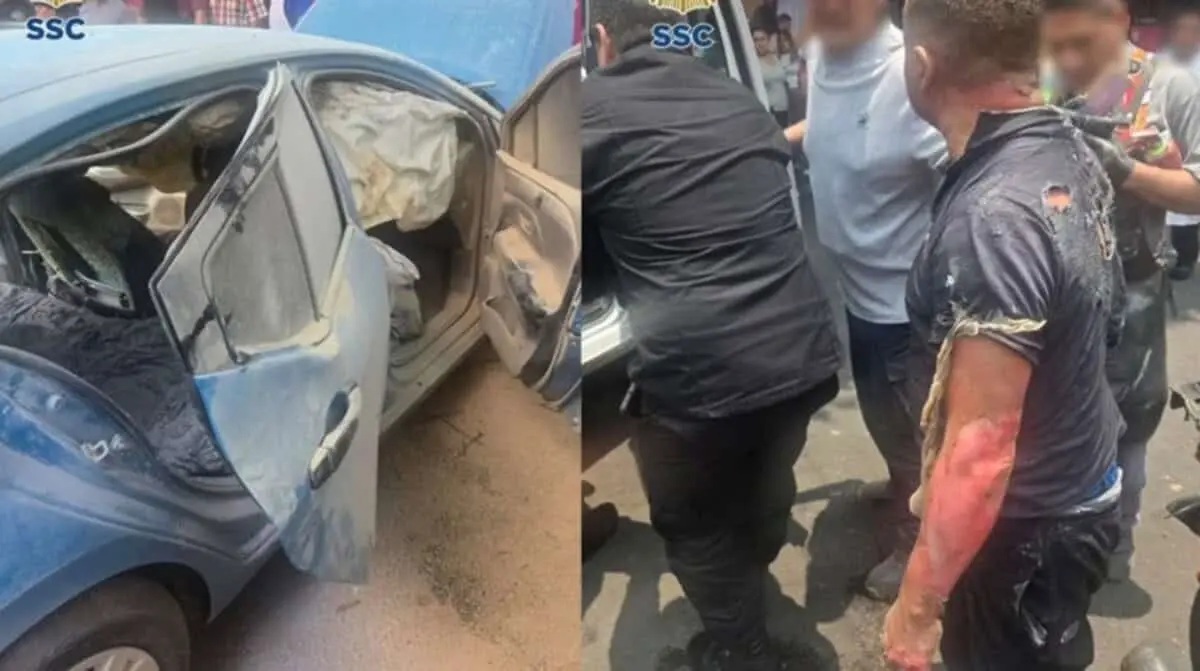  Explosión por un tanque de gas en la cajuela de un vehículo en Tacubaya dejó como saldo a un padre y su hijo heridos. 