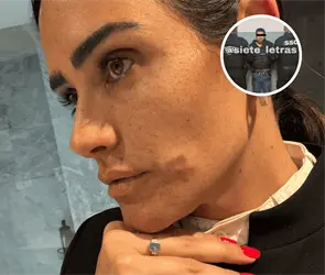 Identifican a presunto agresor de Alessandra Rojo de la Vega en trifulca de la Zona Rosa