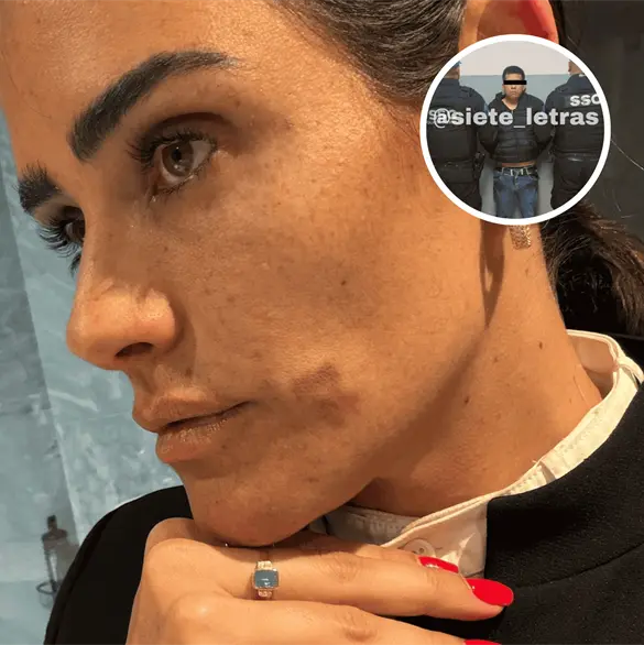 Identifican a presunto agresor de Alessandra Rojo de la Vega en trifulca de la Zona Rosa Identifican a presunto agresor de Alessandra Rojo de la Vega en trifulca de la Zona Rosa