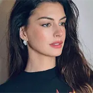 Este es el antes y después de Anne Hathaway Este es el antes y después de Anne Hathaway
