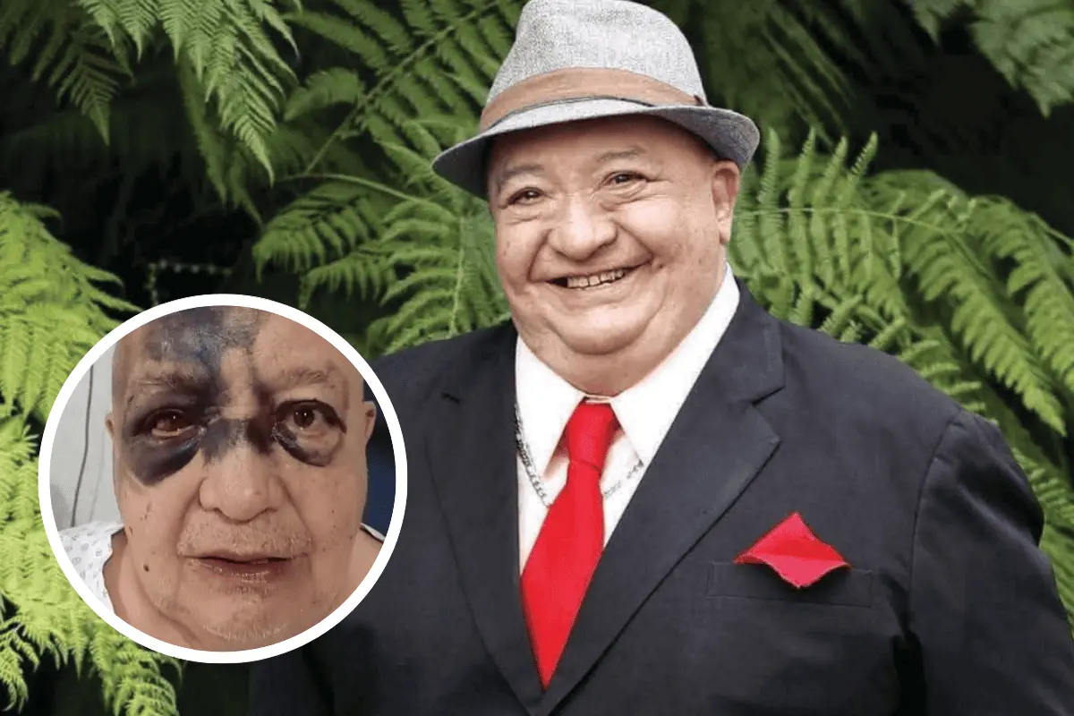  Luis de Alba es hospitalizado 