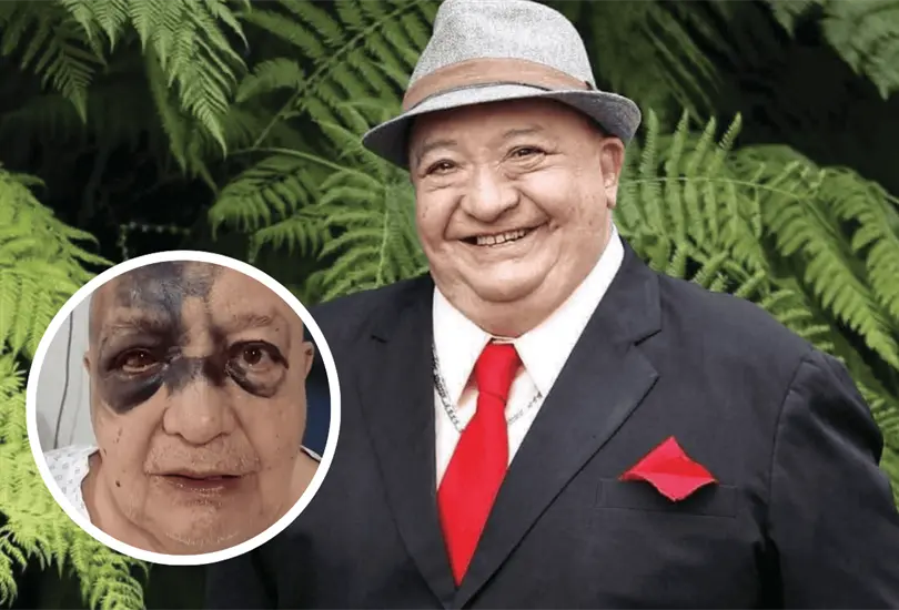 Luis de Alba es hospitalizado