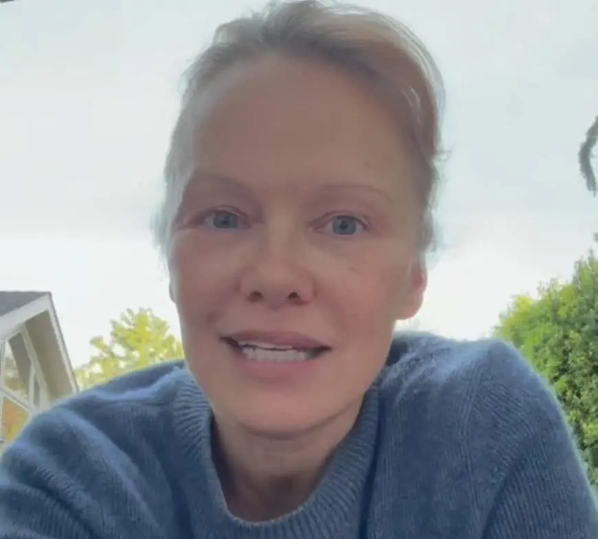 Este es el antes y después de Pamela Anderson Este es el antes y después de Pamela Anderson