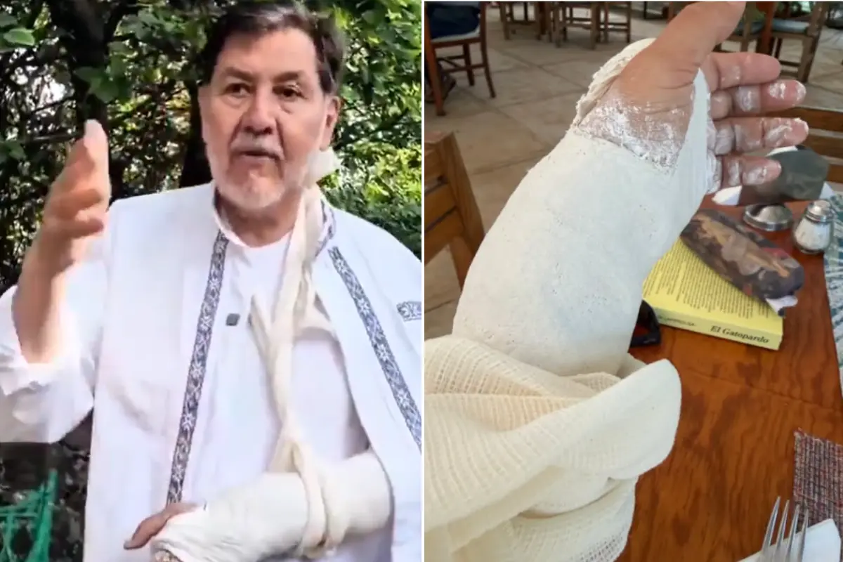  Así fue la caída que dejó a Noroña con la muñeca fracturada 