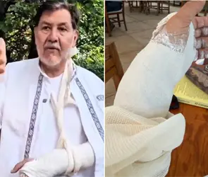 No supe ni cómo: Así fue la caída que dejó a Noroña con la muñeca fracturada No supe ni cómo: Así fue la caída que dejó a Noroña con la muñeca fracturada