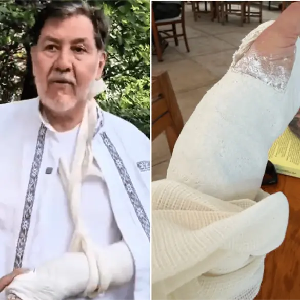 No supe ni cómo: Así fue la caída que dejó a Noroña con la muñeca fracturada No supe ni cómo: Así fue la caída que dejó a Noroña con la muñeca fracturada